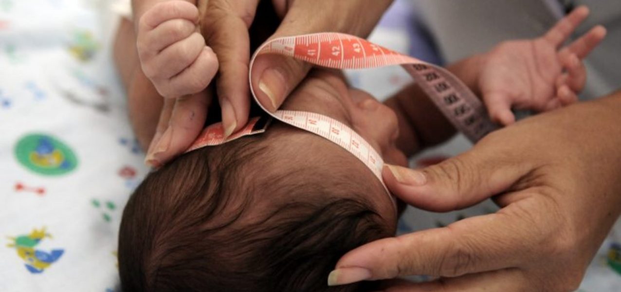 169955criancas-com-sindrome-congenita-do-zika-terao-indenizacao-e-pensao-vitalicia-3