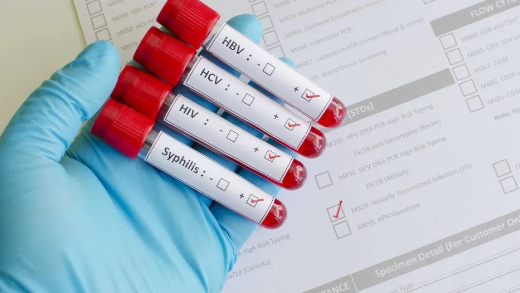 5a926330-e3e8-4aaa-9280-4ee1b2cafa53