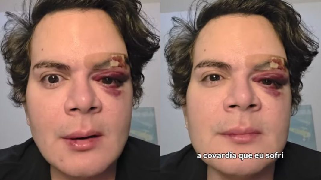 agressao_instagram_widelg