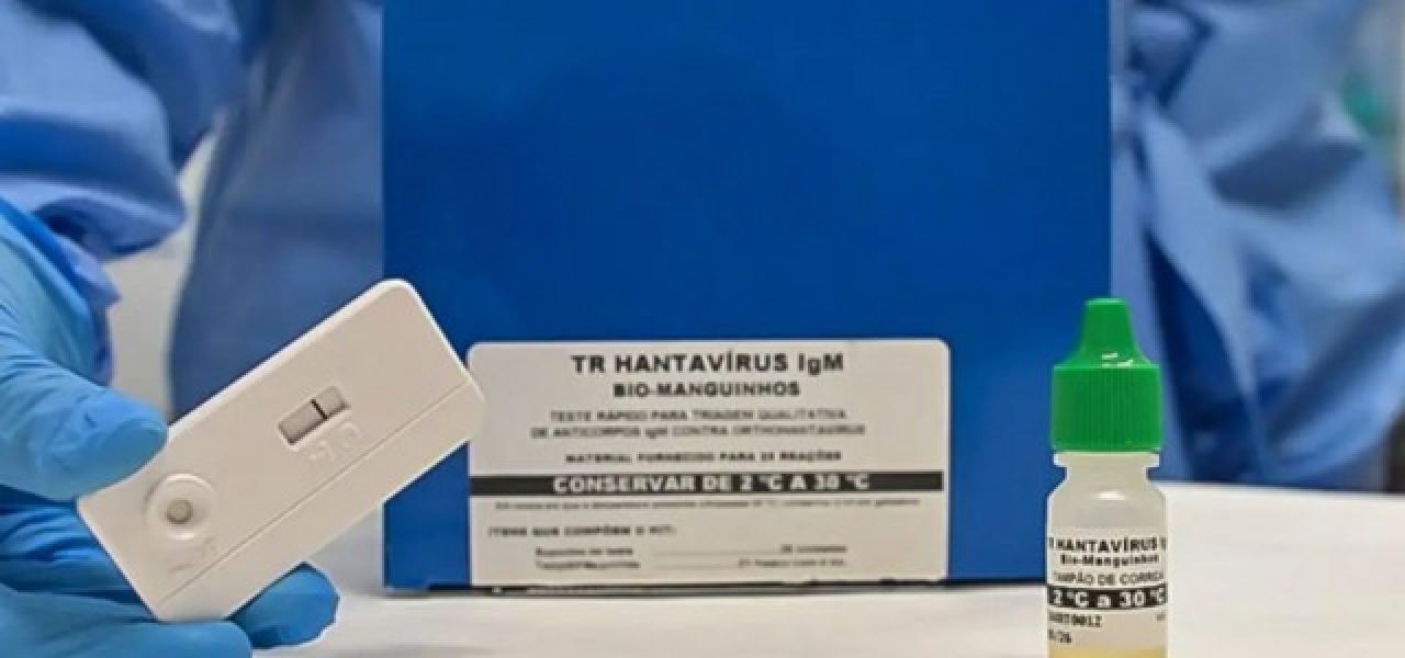 b2ap3_medium_174586anvisa-aprova-teste-rapido-que-detecta-hantavirose-em-20-minutos-3