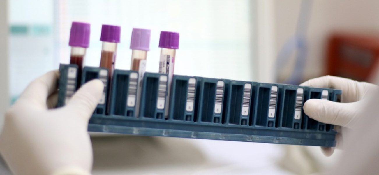 coleta-de-exame-de-sangue